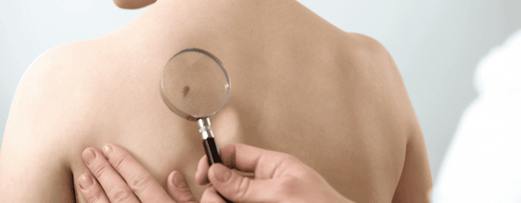 Michail Poloutenko – dermatovenerologas Vilniuje 1 michail-poloutenko-dermatovenerologas-vilniuje